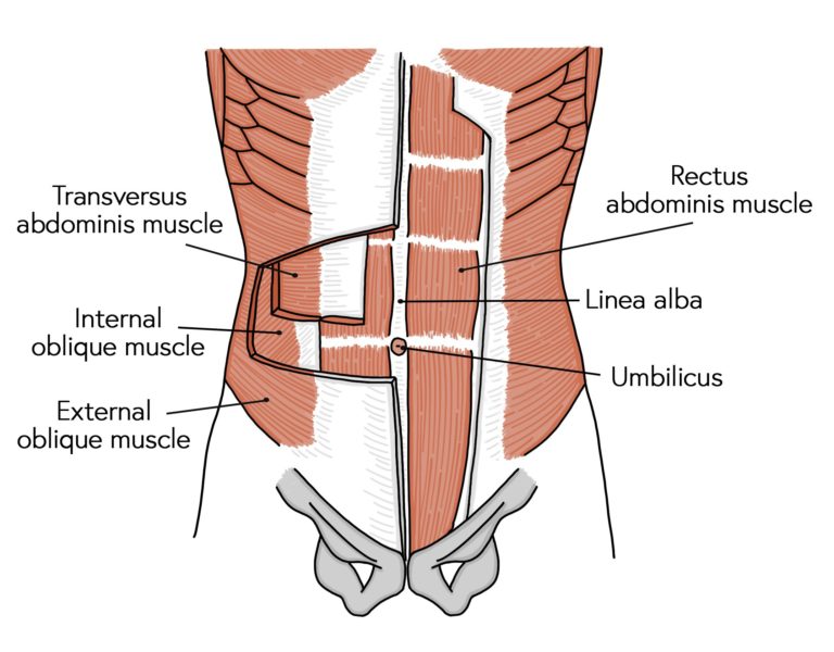 Position of the abdominal muscles