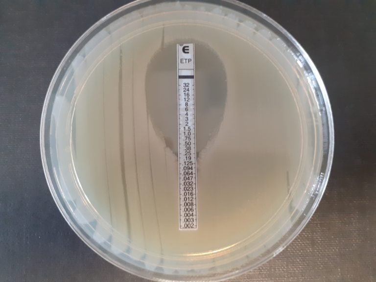 ertapenem gradient strip test