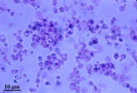 Histoplasma capsulatum under the microscope, in yeast form