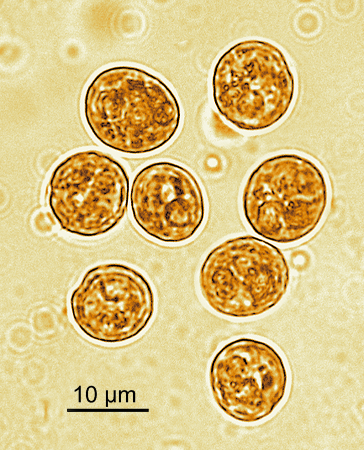 Microscopic image of the world’s most heat tolerant coral symbiont species, shows 9 circular structures with white halos and some kind of internal structure.