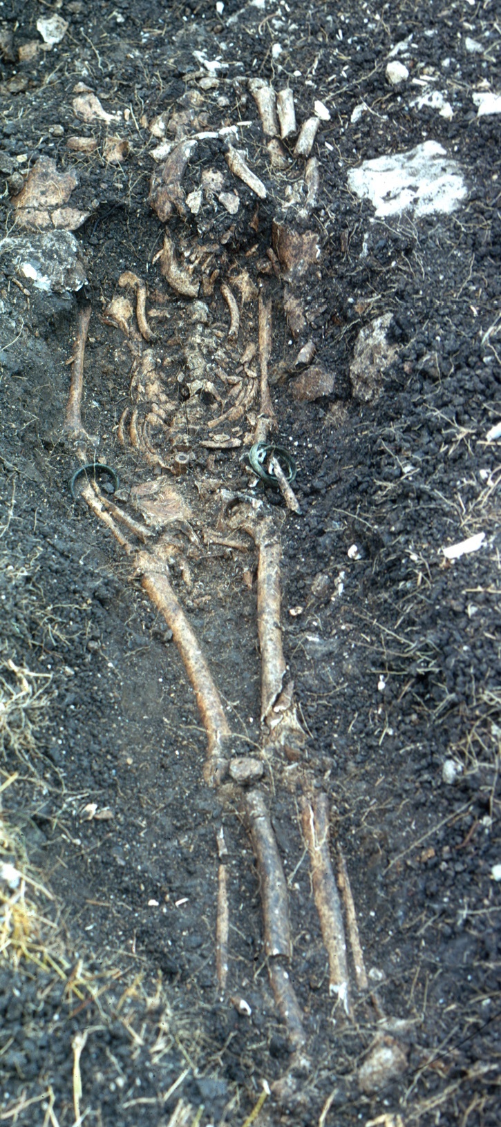 Skeleton and Burial, Newton Plantation Slave Cemetery, Barbados