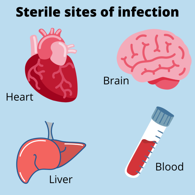 image of sterile sites of infection - heart, brain, liver and blood
