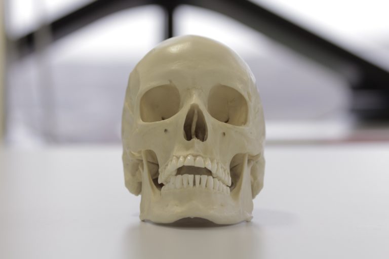 A European skull showing circular eye sockets with squared margins and a high nasal aperture