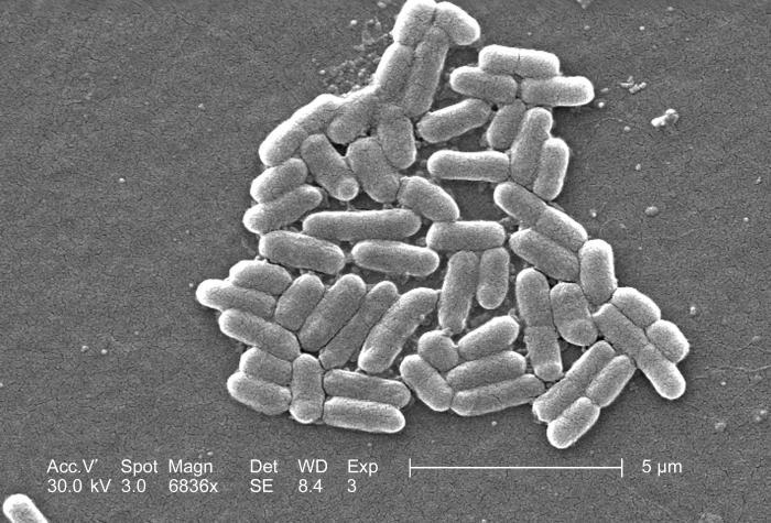Image depicts two Gram-negative, rod-shaped, Escherichia coli bacteria
