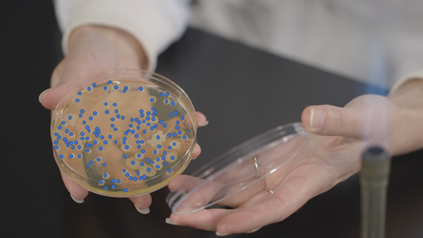 Photo of dilution on a tryptic soya agar (TSA) plate as above but with blue dots over the colonies