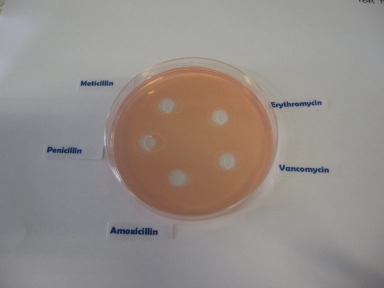 picture of agar plate with labels from left to right: Penicillin, Meticillin, Erythromycin, Vancomycin, Amoxicillin