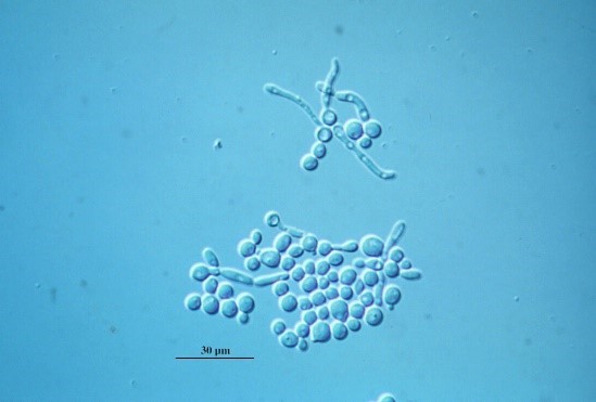 Another cluster of yeasts with long, thin pseudohyphae visible