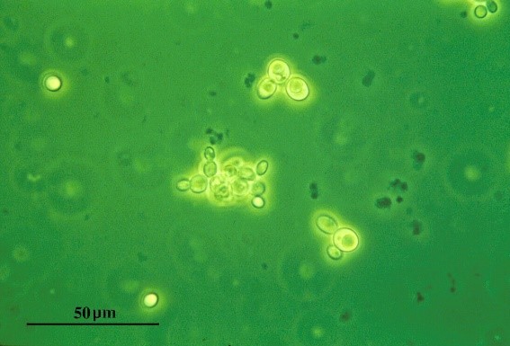 Clusters of yeast cells during the budding process