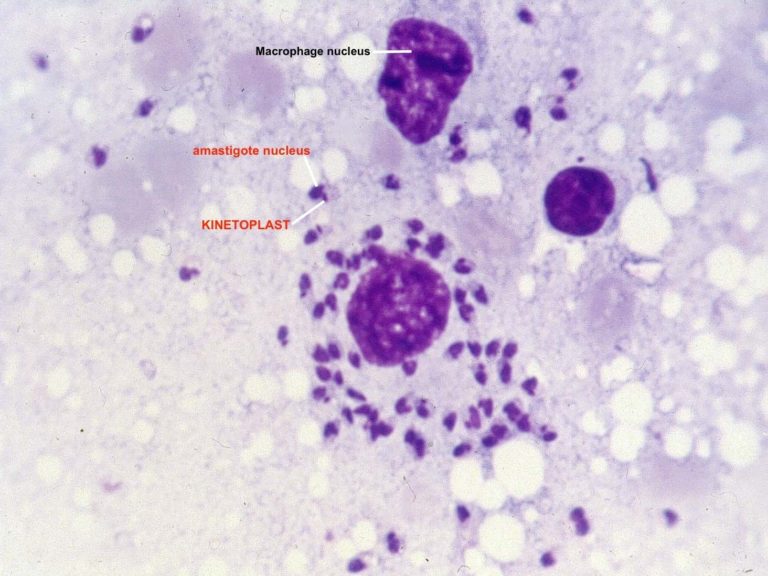 Microscopic view-field of infected macrophages with Leishmania amastigotes under the 100x objective, after Giemsa staining.