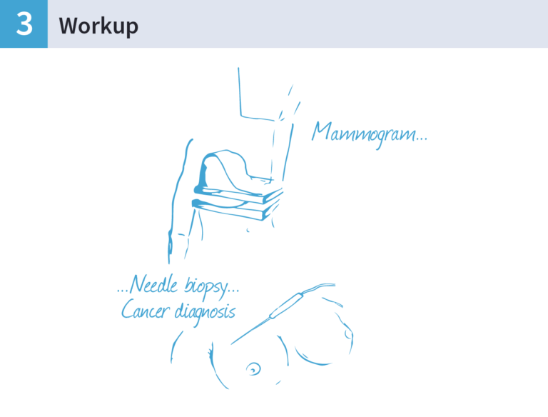 An illustration of a mammogram and a needle biopsy.