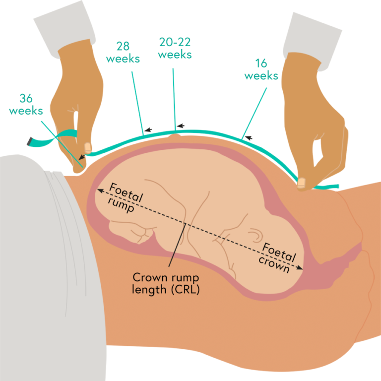 Illustration showing how to measure symphysis-fundal height from the foetal crown to the foetal rump