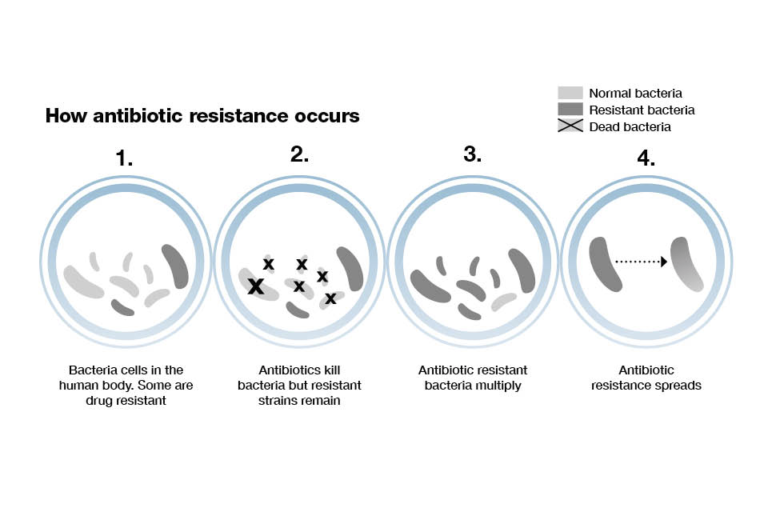 'How antibiotic resistance occurs'. This image shows the four steps of ABR: 1. Some bacteria cells in human body are resistant, 2. Antibiotics kill bacteria but resistant bacteria remain, 3. Antibiotic resistant bacteria multiply, 4. Antibiotic resistance spreads.