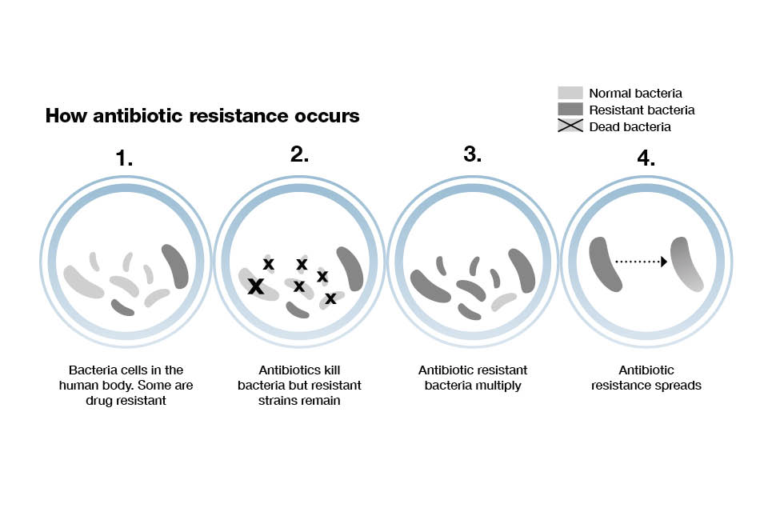 how-does-antibiotic-resistance-develop-and-spread