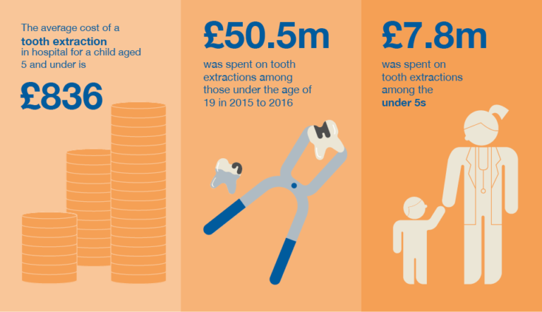 Infographic - average cost of tooth extraction for child 5 and under is £836, £50.5million spent on tooth extractions in those under 19 in 2015 and 2016, £7.8million spent on tooth extractions in under 5s