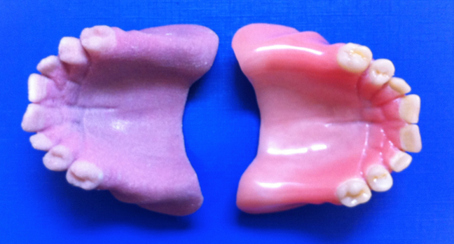 3D Printed Denture