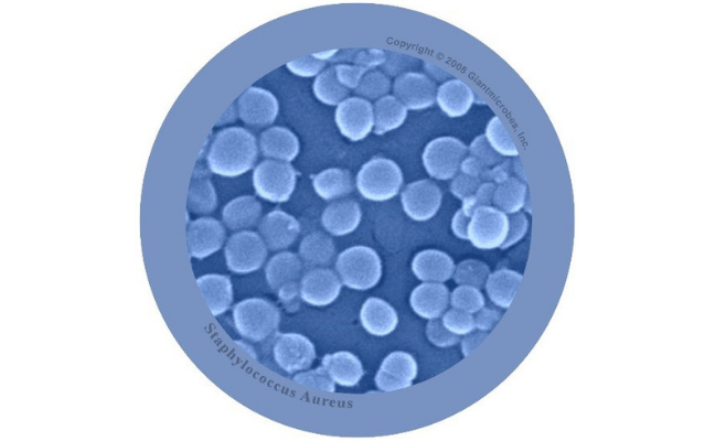 Close up image of Staphylococcus aureus (bacteria)