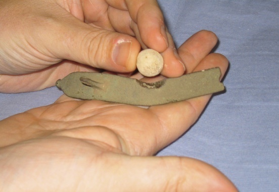 Photo showing how damage to the backstrap from Brown Bess trigger guard matches in size to a French musket ball.