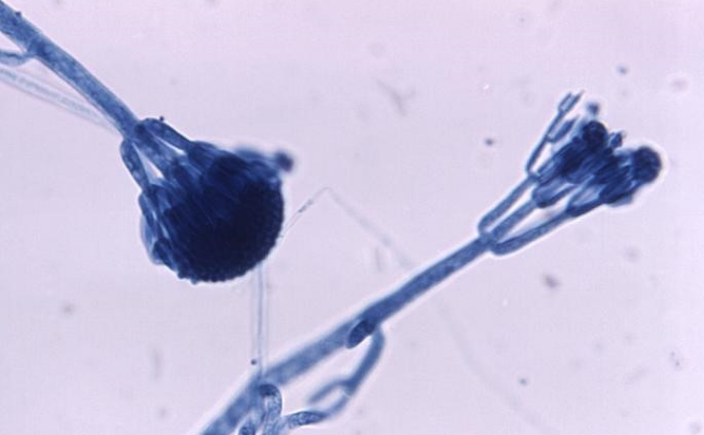 Close up of Penicillium (fungus which produces penicillin)