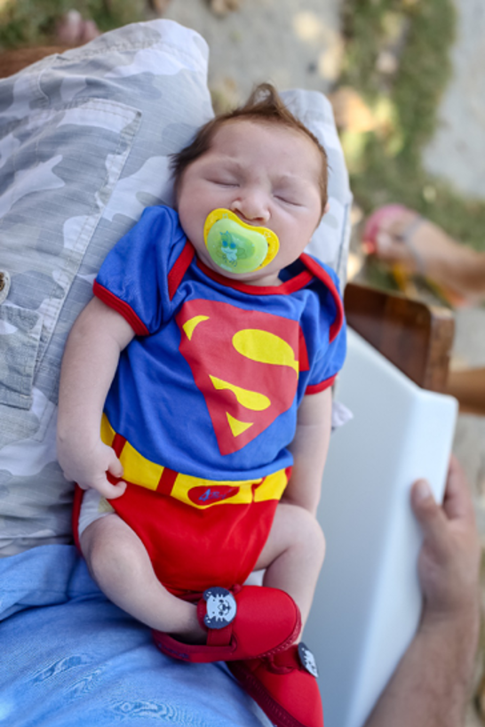 Baby with congenital zika syndrome asleep on mother's knees, wearing a superman outfit