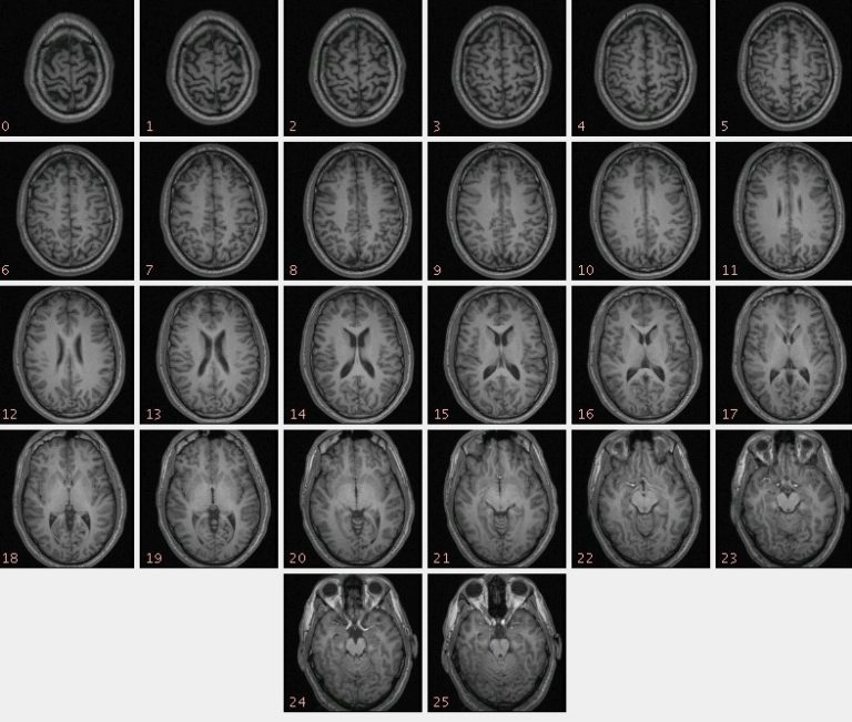 fMRI Output