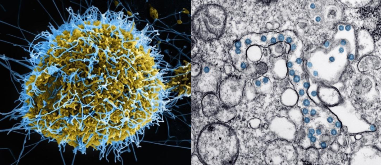 SEM image of Ebola virus particles being released and TEM image of SARS-CoV-2 virus particles