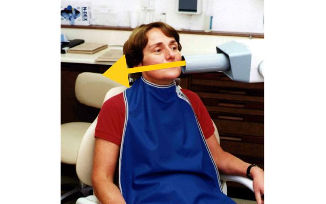 photo of person receiving intra-oral radiograph, with a large arrow showing that the x-radiation goes through their head and mouth area, but not through the torso.