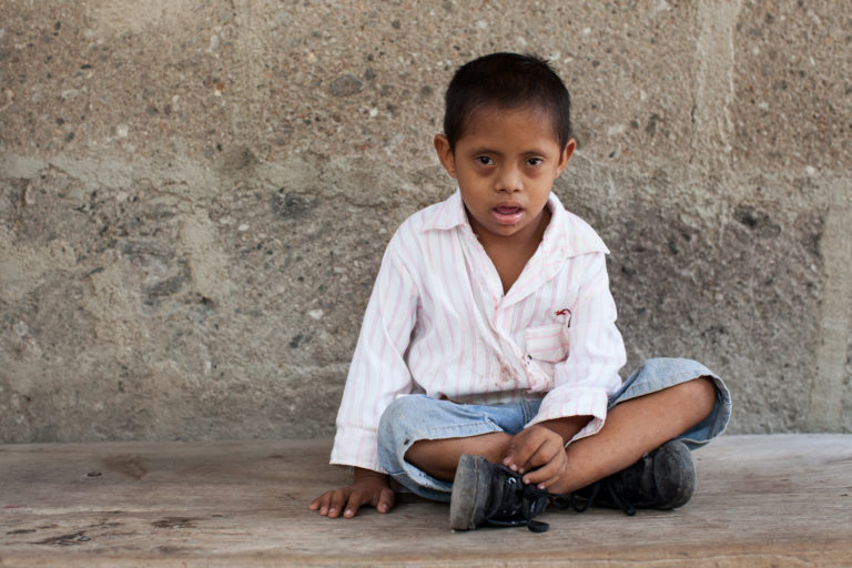 A young boy with Down syndrome sitting crossed legged on the floor.