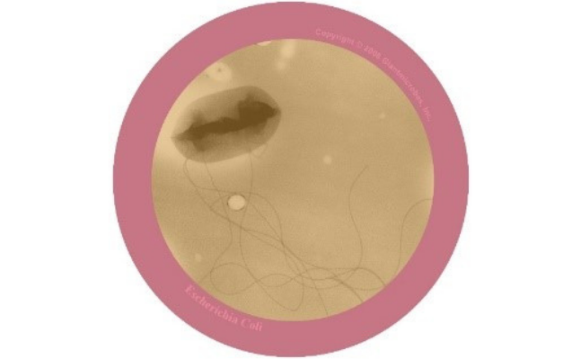 Close up of E. coli.
