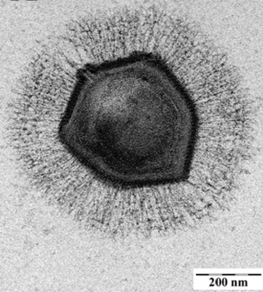 Mimivirus particle, electron microscopy